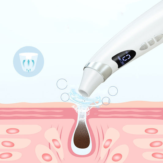 Electric Visual Blackhead Suction Instrument with HD Camera – Deep Pore Cleaner for Face with 4 Skin-Friendly Tips - BudgetSpender